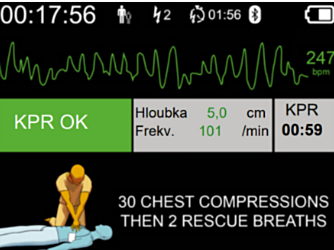 DefiSign Pocket Plus Option Affichage ECG - 11527